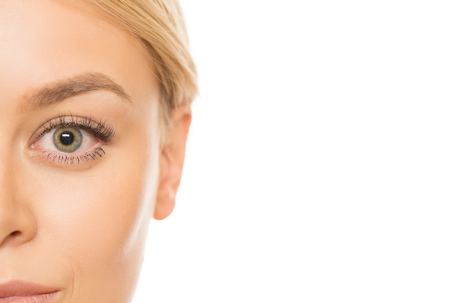 Blépharoplastie